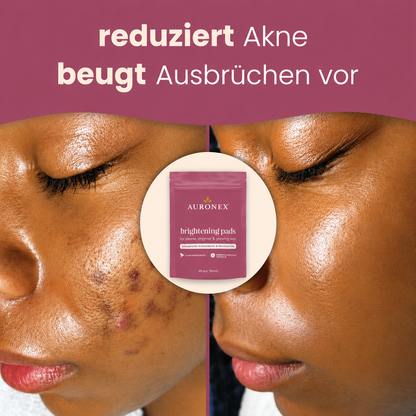 Aufhellende Kurkuma- und Kojisäure-Pads
