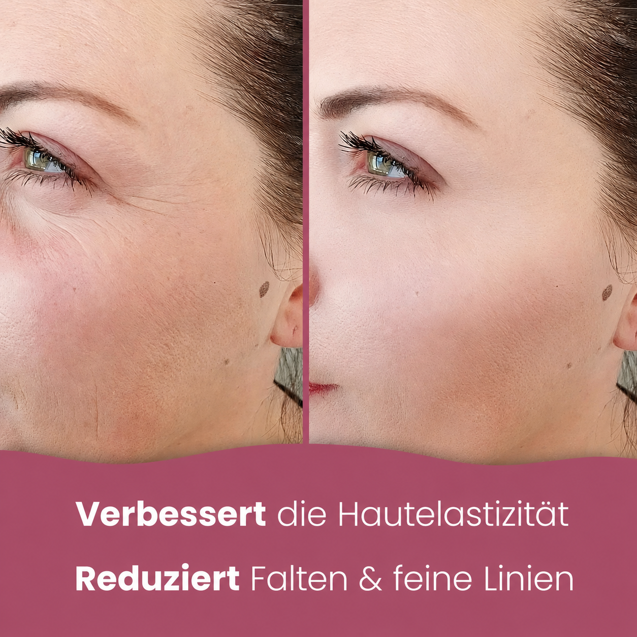 Aufhellende Kurkuma- und Kojisäure-Pads